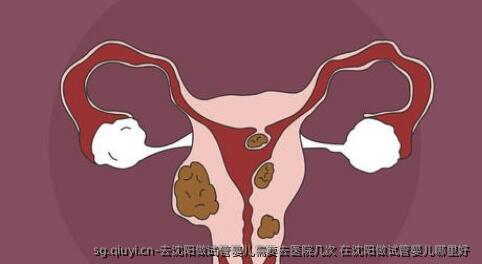 去沈阳做试管婴儿需要去医院几次 在沈阳做试管婴儿哪里好 