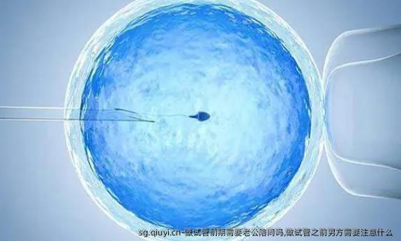 做试管前期需要老公陪同吗,做试管之前男方需要注意什么 