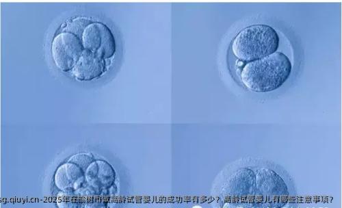 2025年在榆树市做高龄试管婴儿的成功率有多少？高龄试管婴儿有哪些注意事项？