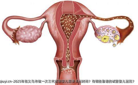 2025年在义乌市做一次三代试管婴儿需要多长时间？有哪些靠谱的试管婴儿医院？