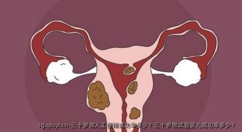 三十岁做人工授精成功率多少？三十岁做试管婴儿成功率多少？