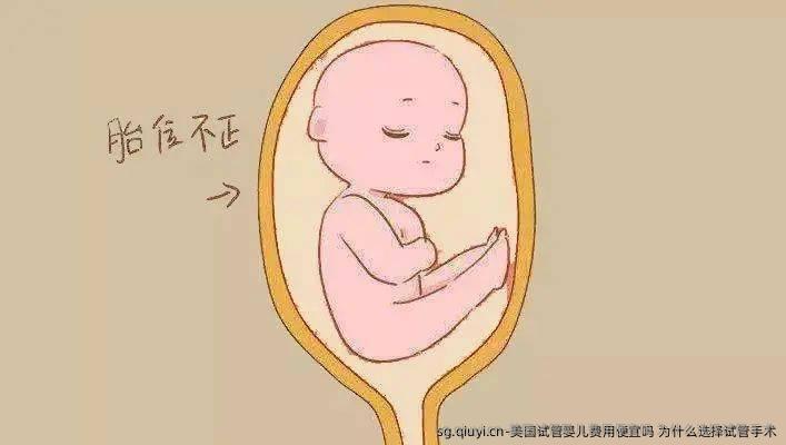 美国试管婴儿费用便宜吗 为什么选择试管手术