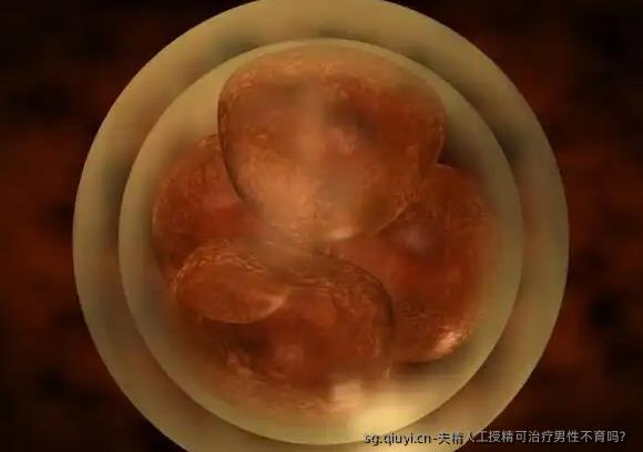 夫精人工授精可治疗男性不育吗？