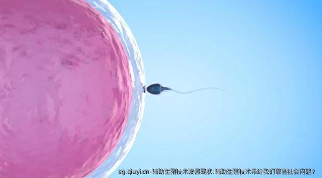 辅助生殖技术发展现状:辅助生殖技术带给我们哪些社会问题？