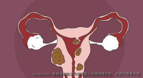 昆明高龄做三代试管婴儿价格详情介绍，试管大概多少钱