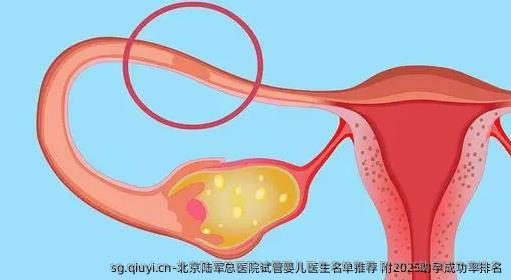 北京陆军总医院试管婴儿医生名单推荐 附2025助孕成功率排名