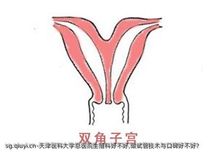 天津医科大学总医院生殖科好不好,做试管技术与口碑好不好?