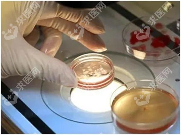 天津哪个医院试管成功率高？可以怀孕吗