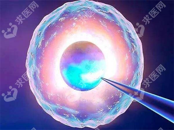 福州试管婴儿的流程是怎样的？具体分为几个步骤